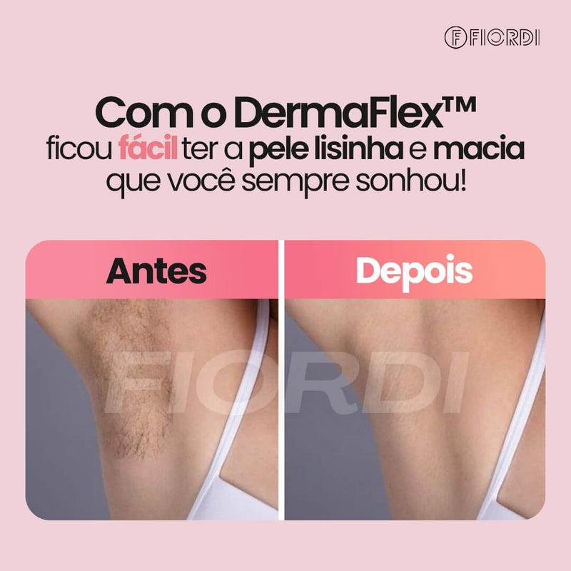 Depilador Elétrico 4 em 1 - DermaFlex™ + Brinde